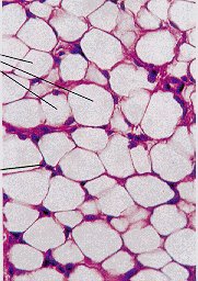 tejido-adiposo-celulitis.jpg